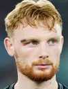 Liam Scales - Celtic Glasgow futbolcusu